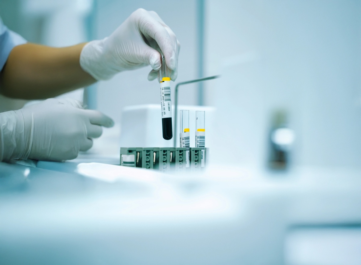 Téli immunerősítés - Milyen laborvizsgálatok segítenek a szezonális betegségek ellen?